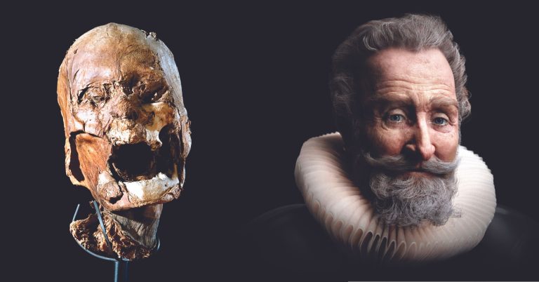 How the voice of Henry IV can help patients who have lost their speech